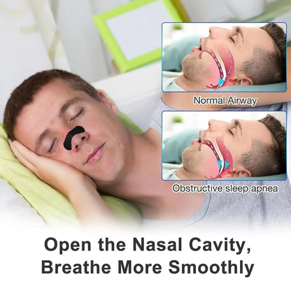 ClearFlow Nasal Strips